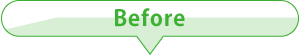 Before Before